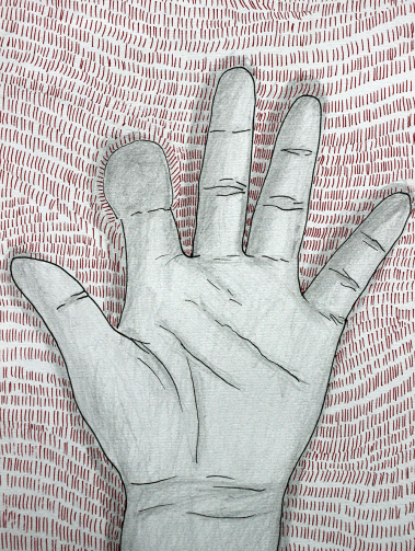 工伤让我成了左撇子